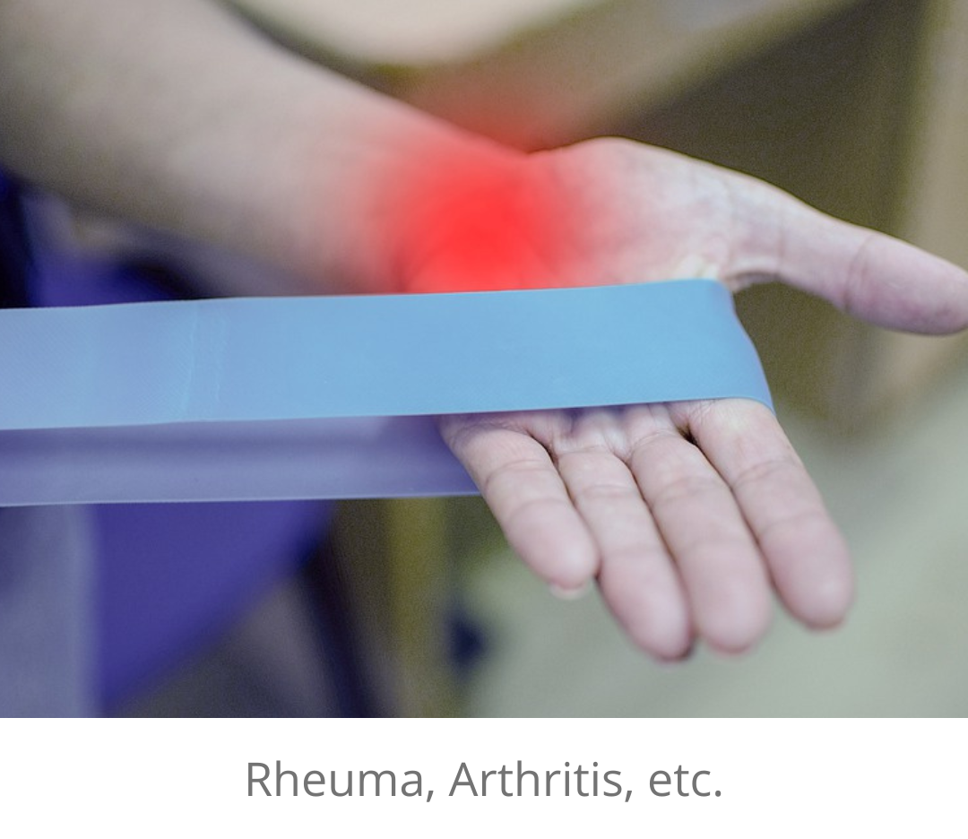 rheuma